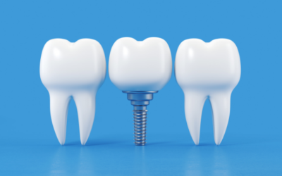 5 Keys To Using Digital Marketing To Grow Your Dental Implant Practice