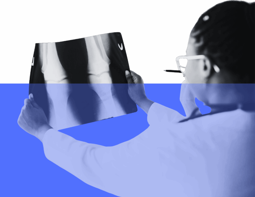 Doctor holding up an X-ray